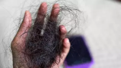 4 Foods to Stop Aggressive Hair Loss and Boost Hair Growth Naturally