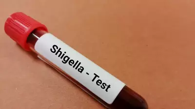 Kerala Reports 10 New Shigella Cases, Total Reaches 120