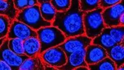 Novel pill daraxonrasib extends survival in advanced pancreatic cancer
