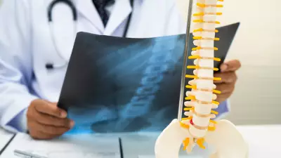 Rare Simultaneous Motion-Preserving Spine Surgery Restores Patient's Mobility