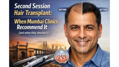 Second Session Hair Transplants: When Mumbai Clinics Recommend and Avoid