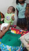 21-day-old infant with rare spinal defect successfully operated in Berhampur
