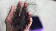 4 Foods to Stop Aggressive Hair Loss and Boost Hair Growth Naturally