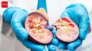 Can Kidneys Fail Without Warning? The Silent Danger of Kidney Disease