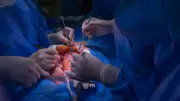 Christiaan Barnard: The Surgeon Who Performed the First Human Heart Transplant