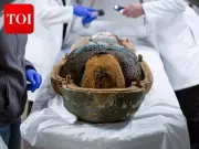 CT Scan Reveals Possible Ancient Spine Surgery in Egyptian Mummy