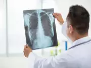 Ex-DGHS procurement chief arrested in health procurement scam in Delhi