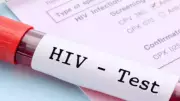 FIR against man, family for hiding HIV status after wife dies