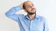 Hair Loss in 20s and 30s: Early Thinning Causes and How to Prevent