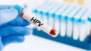 India Validates Indigenous HPV Test for Cervical Cancer Screening