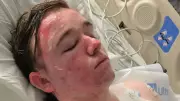 McDonald's Employee Doused with Hot Oil by Co-Worker in California