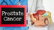 New Precision Radiotherapy Cuts Prostate Cancer Sessions to Five in England