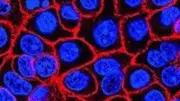 Novel pill daraxonrasib extends survival in advanced pancreatic cancer