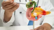 Pancreatic Cancer: The Silent Killer That Hides in Plain Sight