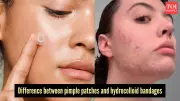 Pimple Patches vs Hydrocolloid Bandages: Which Is Better for Your Skin?