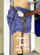 Rare CT Scan on Injured Cobra Saves Its Life in Navi Mumbai