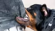Rottweiler attack victim undergoes surgery; owner blames handler