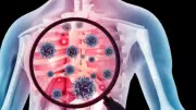 Silent TB Epidemic: Over 34% Cases in Northeast Show No Symptoms