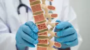 Think Osteoporosis Is Only a Women's Disease? Men Should Be Concerned Too