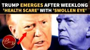 Trump's Swollen Eye Sparks Health Concerns After Week-Long Absence