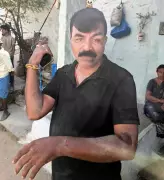 Two Police Personnel Injured in Attack During Arrest in Ballari Village