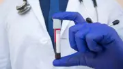Why Blood Tests Are Crucial During Pregnancy for Indian Women