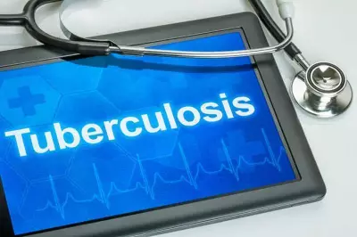 Kangra Leads Himachal in TB Prevention with 91% Coverage