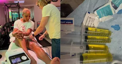 Knee Effusion Forced Serena Williams to Withdraw from Wimbledon 2026