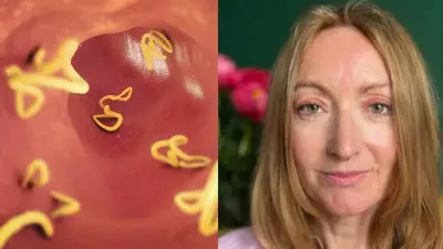 UK woman claims Indian food gave her brain parasites, sparks health debate