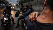 Fake Bite Mark Exposes Rs 37.5 Lakh Robbery Conspiracy in Delhi