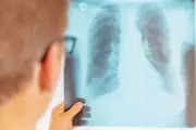 ICMR Invites Research Proposals to Accelerate TB Elimination in India