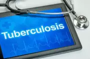 Kangra Leads Himachal in TB Prevention with 91% Coverage