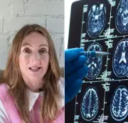 UK Woman Found 38 Brain Parasites After India Trip: What Is Neurocysticercosis?